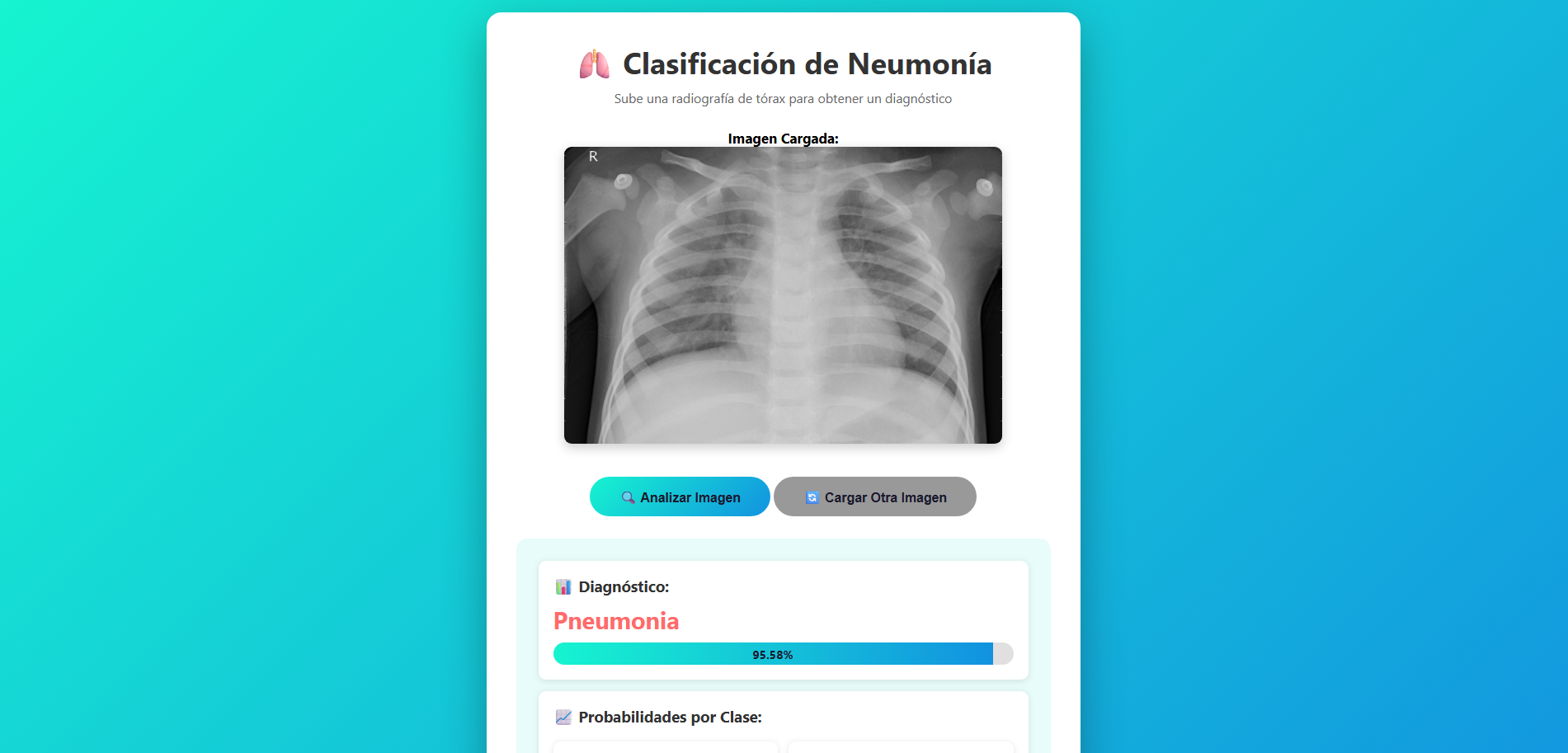 Pneumonia Classification API
